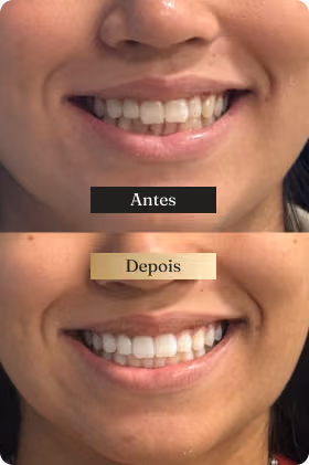 Depoimento 1