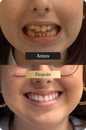 Depoimento 2