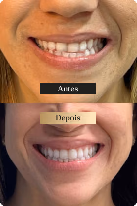 Depoimento 3